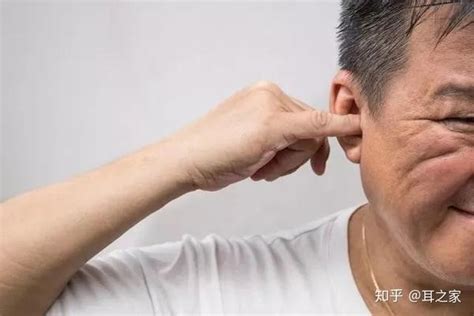 左耳朵痒代表什么 門牙大顆面相